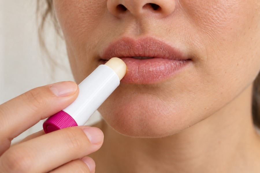 Nahaufnahme trockener Lippen, auf die ein farbloser Lippenbalm mit weißer Hülse und magentafarbenem Drehfuß aufgetragen wird.